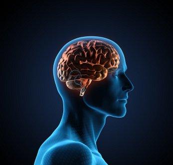 أربع مسببات للسكتة الدماغية